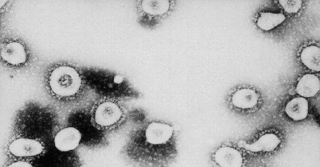 coronavirus US