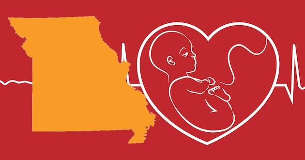 missouri heartbeat bill unborn clergy-led